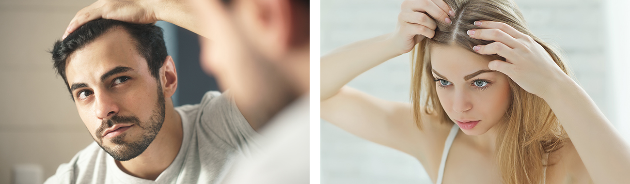 Metodi di infoltimento capelli Milano